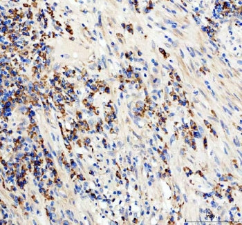 IHC staining of FFPE human appendix tissue with anti-CD19 antibody. HIER: boil tissue sections in pH