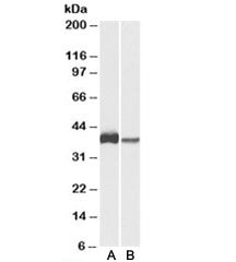 Western blot testing of U937 [A] and human spleen [B] lysates with CAPG antibody at 0.3ug/ml. Predic
