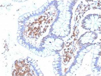 IHC testing of FFPE human colon stained with MAPK14 antibody. Required HIER: boiling tissue sections