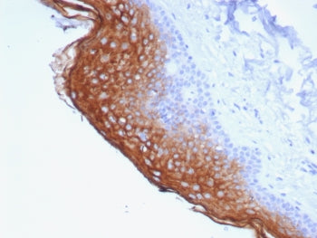 IHC staining of FFPE human skin tissue with Suprabasin antibody (clone SBSN/7964). HIER: boil tissue
