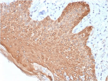 IHC staining of FFPE human skin with recombinant Multi Cytokeratin antibody (clone rKRT/457). HIER: 