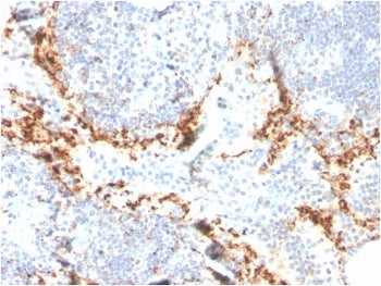 HAVCR2 Antibody / TIM-3