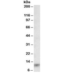Western blot testing of human lung lysate with S100A8 antibody at 0.03ug/ml. Predicted molecular wei
