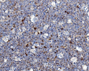 IHC staining of FFPE human tonsil with NCF2 antibody. HIER: boil tissue sections in pH8 EDTA for 20 