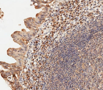 IHC testing of FFPE human epityphlon tissue with USP15 antibody. HIER: steam section in pH9 EDTA for