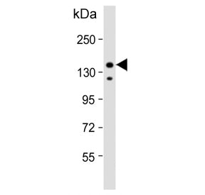Western blot testing of human HeLa cell lysate with Insulin receptor substrate 2 antibody. Predicted