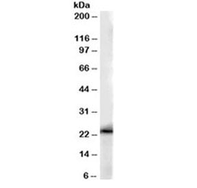 Western blot testing of human kidney lysate with GSTP1 antibody at 0.01ug/ml. Predicted molecular we