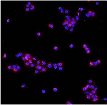 PDE6 beta Antibody / PDE6B