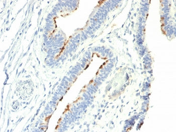 Thomsen-Friedenreich Antigen Antibody / CD176