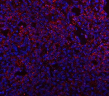 Prosaposin Antibody / PSAP