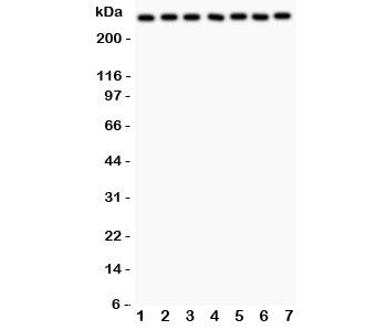 Western blot testing of LRRK2 antibody and Lane 1: rat brain; 2: mouse brain; 3: (r) liver; 4: human