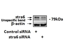 Western blot testing of siRNA-mediated STRA6 expression in 3T3-L1 lysate with STRA6 antibody at 1.7u