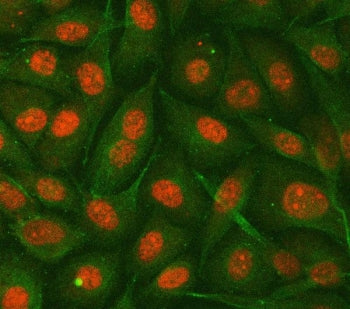 hnRNP E2 Antibody / Heterogeneous nuclear ribonucleoprotein E2 / PCBP2
