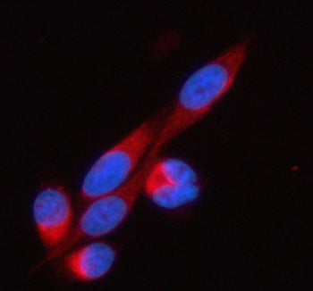 Immunofluorescent staining of SOAT1 using anti-SOAT1 antibody (red). SOAT1 was detected in an immuno