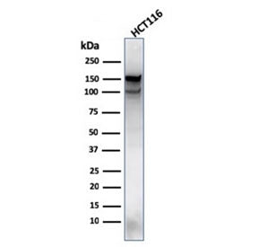 Western blot testing of human HCT116 lysate with MSH6 antibody (clone MSH6/3089). Expected molecular