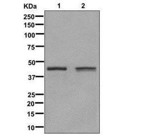 Western blot testing of human 1) Jurkat and 2) HeLa cell lysate with Glutamine Synthetase antibody. 