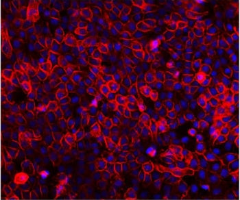 Immunofluorescent staining of FFPE human A431 cells with EGF Receptor antibody (red) and DAPI nuclea