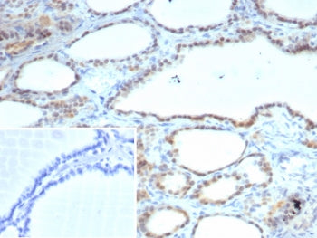 IHC staining of FFPE human thyroid tissue with S100A13 antibody (clone S100A13/7484). Inset: PBS use