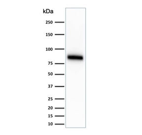 Western blot testing of human HeLa cell lysate with anti-CD44 antibody (clone SPM544). Predicted mol