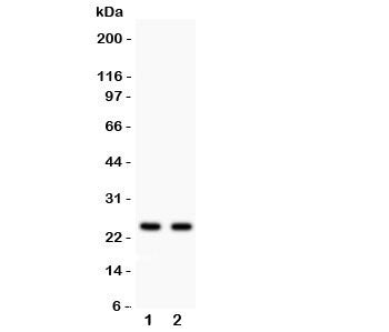 Western blot testing of Rab3A antibody and Lane 1: rat brain; 2: mouse brain lysate