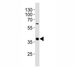 Western blot analysis of lysate from human spleen tissue lysate using CD40 antibody diluted at 1:100