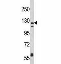 Western blot analysis of CD11c antibody and MDA-MB231 lysate. Predicted molecular weight: 128~150 kD