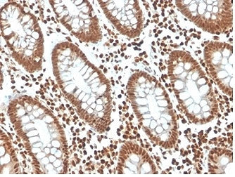 p27Kip1 Antibody / p27 / CDKN1B