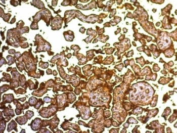 Placental Alkaline Phosphatase Antibody / ALPP