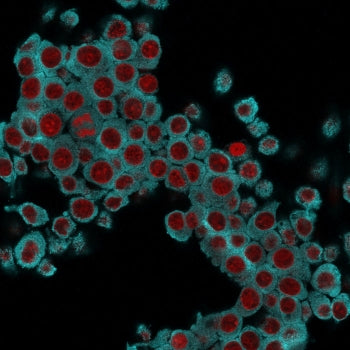Immunofluorescent staining of fixed mouse RAW cells with Cytokeratin 6 antibody (clone SPM269, cyan)