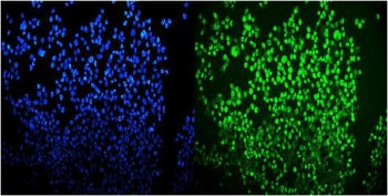OGT Antibody