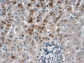 IHC testing of FFPE human liver with USP15 antibody at 2ug/ml. HIER: steamed with pH6 citrate buffer