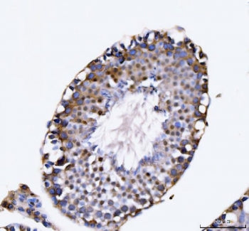 KIFC1 Antibody