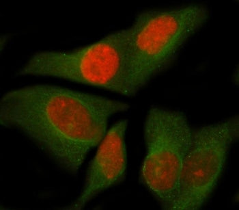 Immunofluorescent staining of FFPE human HeLa cells with NOC4L antibody (red) and Beta Tubulin mAb (