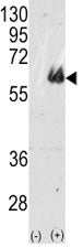 Western blot analysis of TAU antibody and 293 cell lysate (2 ug/lane) either nontransfected (Lane 1)