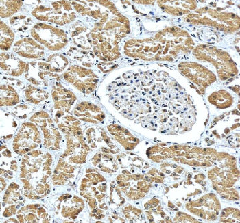 IHC staining of FFPE human kidney tissue with CBS antibody, HRP-secondary and DAB substrate. HIER: b