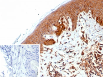 NME2 Antibody / Nucleoside diphosphate kinase B / NDKB