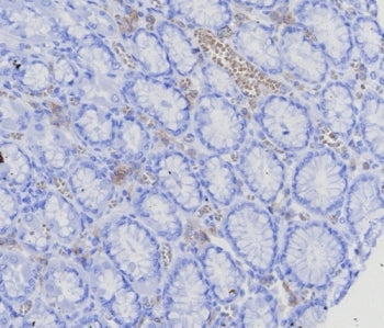 IHC staining of FFPE human stomach (corpus) with BCMA antibody (clone CD269/8125R). HIER: boil tissu