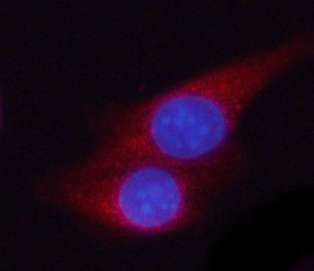 PGK2 Antibody / Phosphoglycerate kinase 2