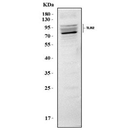 Western blot testing of mouse RAW264.7 cell lysate with Toll-like receptor 2 antibody. Predicted mol