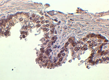 IHC staining of FFPE human prostate tissue with FOXA1 antibody at 2ug/ml. HIER: steamed with pH6 cit