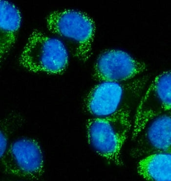 MEK5 Antibody / MAP2K5
