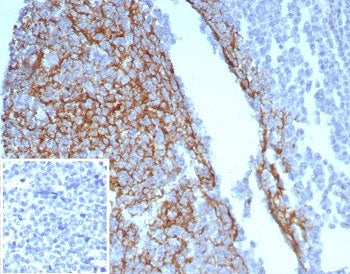 CD23 Antibody