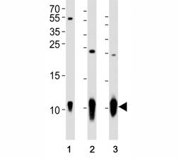 Western blot analysis of lysate from (1) A431 cell line, (2) mouse brain and (3) rat brain tissue us