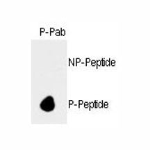 Dot blot analysis of phospho-Rb antibody. 50ng of nonphos-peptide or phos-peptide were adsorbed on t