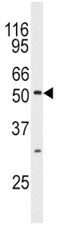 JNK3 Antibody (MAPK10)