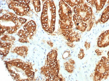 TROP2 Antibody / TACSTD2