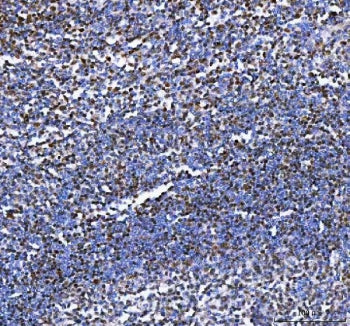 IHC staining of FFPE human tonsil tissue with Aiolos antibody. HIER: boil tissue sections in pH8 EDT