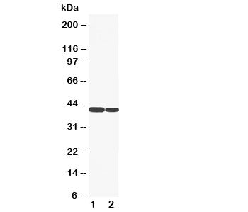 Western blot testing of Cytokeratin 19 antibody and Lane 1: HT1080; 2: COLO320 cell lysate. Predicte