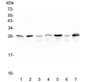 Western blot testing of 1) rat skeletal muscle, 2) rat lung and mouse 3) spleen, 4) skeletal muscle,