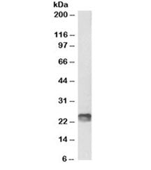 Western blot testing of mouse spleen lysate with biotinylated SOCS1 antibody at 1ug/ml. Predicted mo